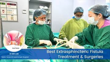 Dr Amita Jain is the best doctor for extrasphincteric fistula surgery